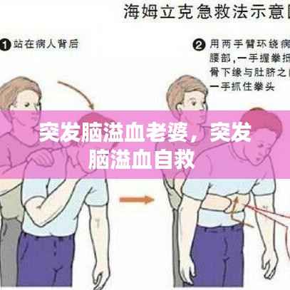 突发脑溢血老婆,突发脑溢血自救