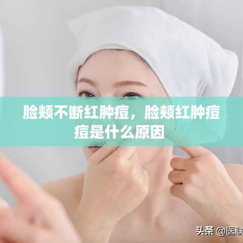 脸颊不断红肿痘,脸颊红肿痘痘是什么原因